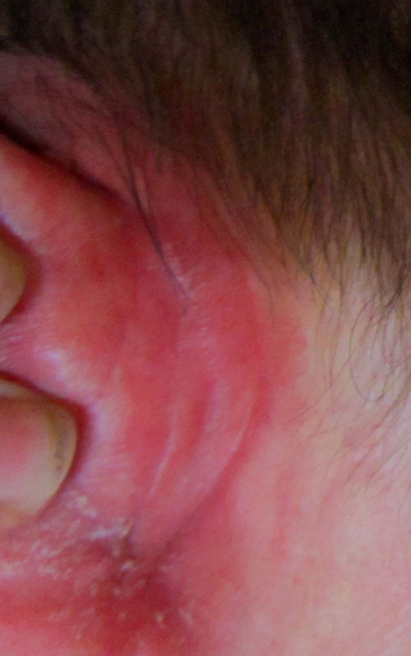 Propecia wirkt nicht Propecia wirkt nicht