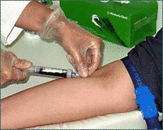 Propecia zusammensetzung